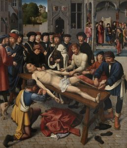 The Judgment of Cambyses (1498) Gérard David, Groeninge Museum, Bruges, BELGIUM which is part of the dermatological iconodiagnosis paintings