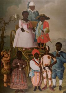 It is a portrait of La Mascarade Nuptiale (1788) by José Conrado Roza exhibited in Musée du Nouveau Monde, La Rochelle, France, that represents a Vitiligo is a depigmenting dermatological, which is part of the dermatological iconodiagnosis paintings.