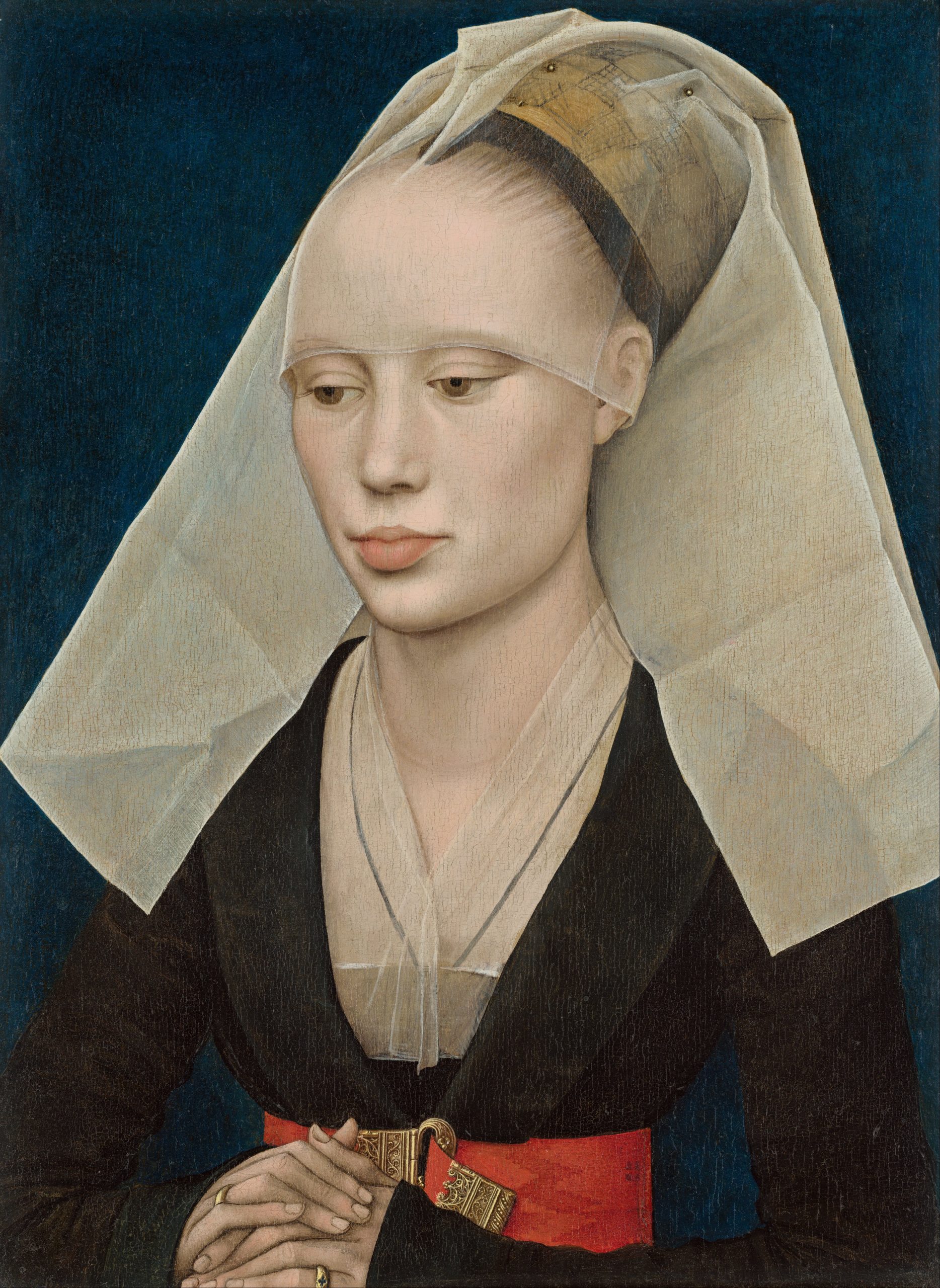 What do these beautiful Renaissance women have in common? Frontal Fibrosing Alopecia